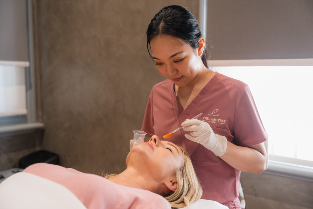 non-invasive-chemical-peel-treatment-for-acne-perth